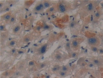 Creatine Kinase MT Antibody in Immunohistochemistry (Paraffin) (IHC (P))