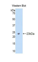 Carbonic Anhydrase VA Polyclonal Antibody