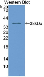 TNP1 Antibody in Western Blot (WB)