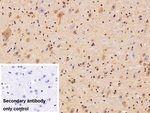SPIN3 Polyclonal Antibody
