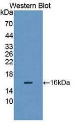 SPIN3 Antibody in Western Blot (WB)