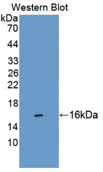 CBY1 Antibody in Western Blot (WB)