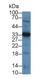 LECT1 Antibody in Western Blot (WB)