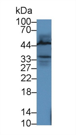 LECT1 Polyclonal Antibody