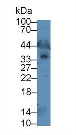 LECT1 Antibody in Western Blot (WB)
