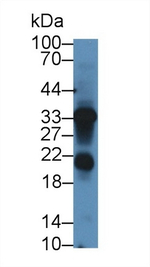 LECT1 Antibody in Western Blot (WB)