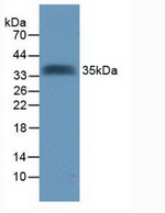 TMEFF2 Polyclonal Antibody