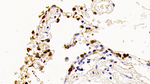 SFTPA2 Antibody in Immunohistochemistry (Paraffin) (IHC (P))