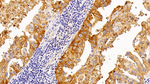 SFTPA2 Polyclonal Antibody