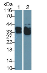 SFTPA2 Antibody in Western Blot (WB)