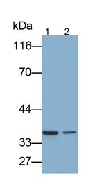 SFTPA2 Antibody in Western Blot (WB)