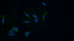 GSTM1 Polyclonal Antibody