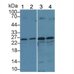 GSTM1 Antibody in Western Blot (WB)