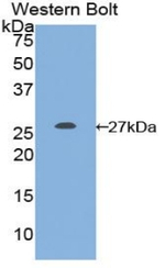 GSTM1 Antibody in Western Blot (WB)