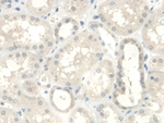 UGCG Antibody in Immunohistochemistry (Paraffin) (IHC (P))
