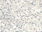 UGCG Antibody in Immunohistochemistry (Paraffin) (IHC (P))