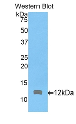 ARPC4 Polyclonal Antibody