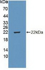 p19 INK4d Polyclonal Antibody