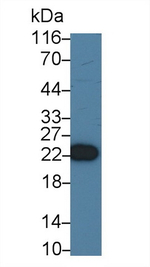 Recoverin Antibody in Western Blot (WB)