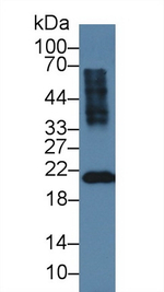 Recoverin Antibody in Western Blot (WB)