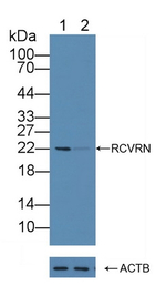 Recoverin Polyclonal Antibody