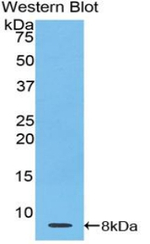 TMSB4X Antibody in Western Blot (WB)