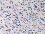 HPGDS Antibody in Immunohistochemistry (Paraffin) (IHC (P))