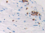 HPGDS Antibody in Immunohistochemistry (Paraffin) (IHC (P))