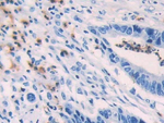 HPGDS Polyclonal Antibody