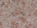 GARS Antibody in Immunohistochemistry (Paraffin) (IHC (P))