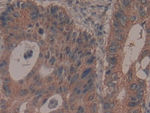 GARS Antibody in Immunohistochemistry (Paraffin) (IHC (P))