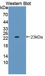 GARS Antibody in Western Blot (WB)