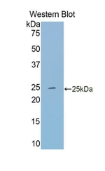 Transferrin Antibody in Western Blot (WB)