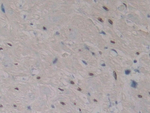 SRF Antibody in Immunohistochemistry (Paraffin) (IHC (P))