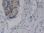 SRF Polyclonal Antibody