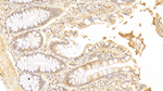 SMOX Polyclonal Antibody