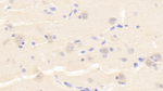 PTPRS Polyclonal Antibody
