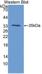 PTPRS Antibody in Western Blot (WB)