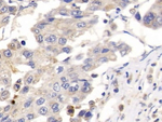 Placental lactogen Antibody in Immunohistochemistry (Paraffin) (IHC (P))