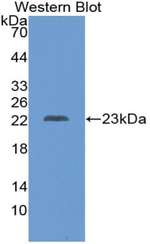Placental lactogen Antibody in Western Blot (WB)