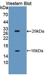 NAIP Antibody in Western Blot (WB)