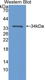NT5C3A Polyclonal Antibody