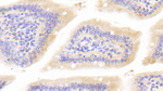 BMP1 Polyclonal Antibody