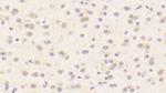BMP1 Antibody in Immunohistochemistry (Paraffin) (IHC (P))