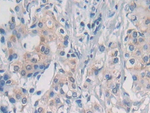 Nesprin 1 Antibody in Immunohistochemistry (Paraffin) (IHC (P))