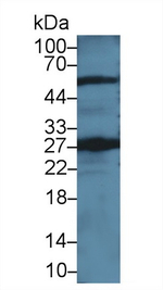 GSTT2 Antibody in Western Blot (WB)