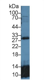 GSTT2 Antibody in Western Blot (WB)
