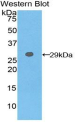 GSTT2 Antibody in Western Blot (WB)