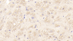 PMP22 Polyclonal Antibody
