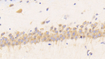 Resistin Polyclonal Antibody